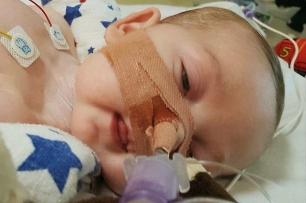 Charlie Gard l&agrave; một trong số 16 trẻ tr&ecirc;n thế giới mắc hội chứng suy nhược ty thể.
