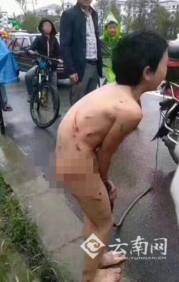 
B&eacute; trai m&igrave;nh đầy thương t&iacute;ch...
