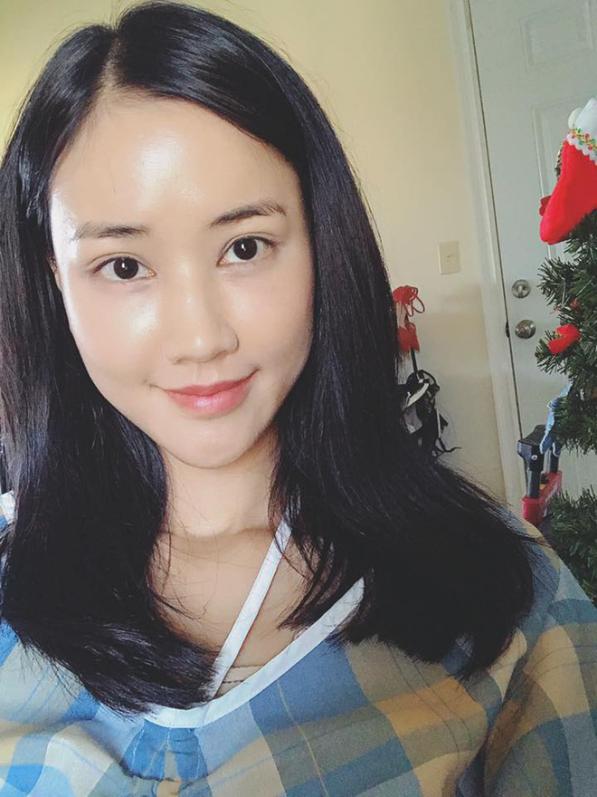 Các nét trên khuôn mặt gần như đã ổn định tới 99%, nhìn qua thì khó có thể thấy dấu hiệu sưng phù hay thâm tím - dấu hiệu phổ biến sau khi thẩm mỹ xong. Thậm chí cô nàng còn khiến nhiều người ghen tị với làn da căng bóng đầy sức sống của mình.