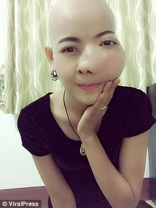 
Jennie Yoo đang bị ung thư miệng giai đoạn cuối với phần má sưng to, không thể ăn, uống hay nói chuyện. Ảnh: ViraPress.
