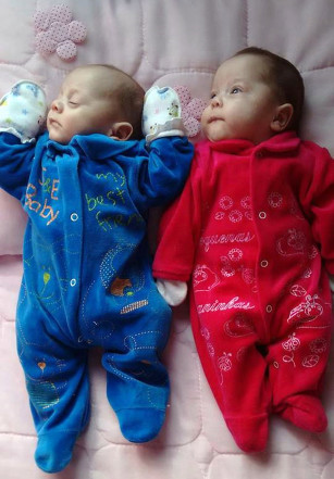 
Cặp song sinh trai gái Asaph và Ana chào đời sau khi người mẹ chết não 123 ngày với mức cân nặng bình thường. Ảnh: Caters News Agency
