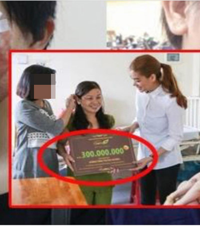 Một trong những bằng chứng Trương Ngọc Ánh đưa ra. Cô cho biết đây là hình ảnh lúc cô vào viện tặng 30 triệu đồng tiền mặt và chị D (người mặc áo xám) chủ đơn vị C đã tặng gói giải phẫu thẩm mỹ trị giá 300 triệu đồng.