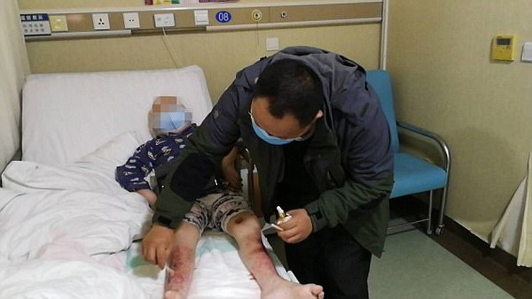 Kuang chăm sóc con trai ở bệnh viện. Anh Kuang nói: Để cứu con trai, chúng tôi sẵn sàng trải qua bất kỳ khó khăn nào.