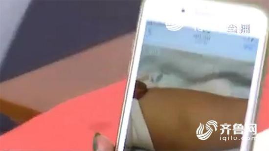 Tr&ecirc;n người đứa b&eacute; vẫn c&ograve;n vết bầm do bị cấu.