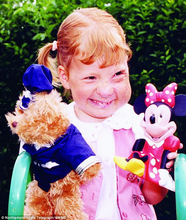 Cody đã phải trải qua 18 cuộc phẫu thuật trong suốt 14 năm. (Ảnh: dailymail)