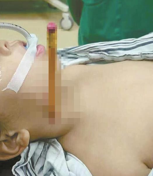 B&eacute; g&aacute;i được đưa v&agrave;o viện trong t&igrave;nh trạng nguy kịch (Ảnh minh họa).