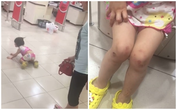 Hình ảnh bé gái bị đánh, đôi chân đầy vết thương được cắt ra từ clip.