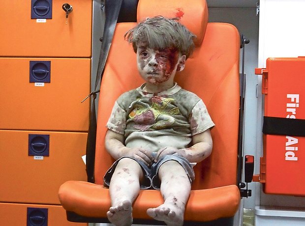 
Omran Daqneesh, cậu bé 5 tuổi được giải cứu khỏi một cuộc không kích năm 2016.
