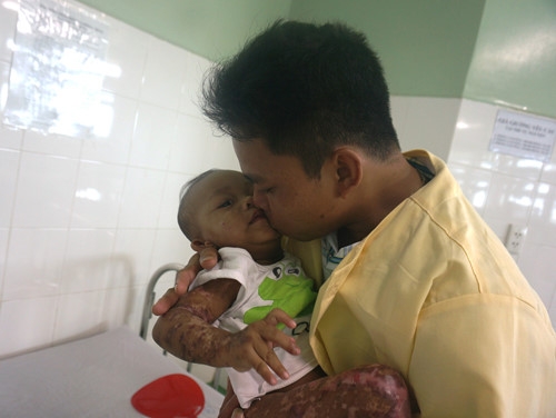 Người cha nhân hậu cưng nựng đứa con trai vừa khuyết đi một phần cơ thể... ẢNH: AN DY