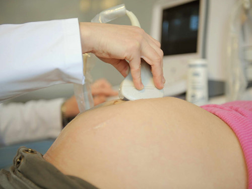 
Bác sĩ nên có thêm câu ghi chú trong phiếu khám thai để tránh hiểu lầm tuổi thai Shutterstock
