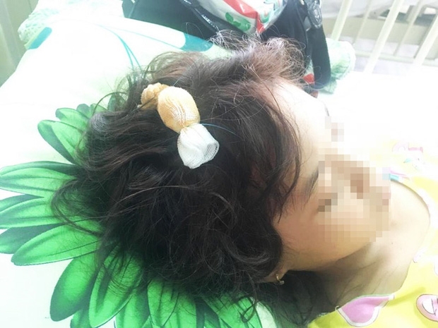 H. là bệnh nhân duy nhất thoát nạn trong vụ TNGT nghiêm trọng ở An Giang trong ngày 2/9.