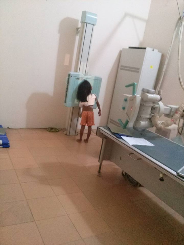 
Tối qua 13/10, bé H. được chuyển xuống bệnh viện tỉnh Vĩnh Phúc để bó bột.
