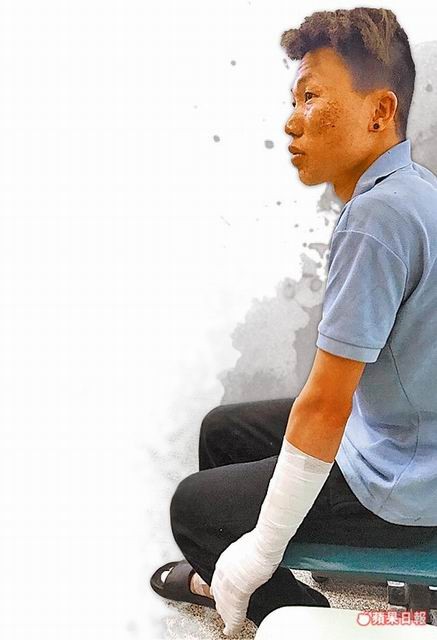 Công nhân Trần Văn Lý bị thương ở cánh tay. Ảnh: Apple Daily.