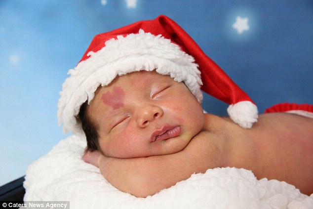 
L&uacute;c t&ocirc;i đưa thằng b&eacute; đi dạo, mọi người đi đường đều tỏ ra t&ograve; m&ograve; v&agrave; tiến lại gần để được ngắm nh&igrave;n Cinar. Họ n&oacute;i rằng vết bớt tr&ecirc;n tr&aacute;n khiến Cinar tr&ocirc;ng v&ocirc; c&ugrave;ng đ&aacute;ng y&ecirc;u, &ocirc;ng bố&nbsp;Murat n&oacute;i.
