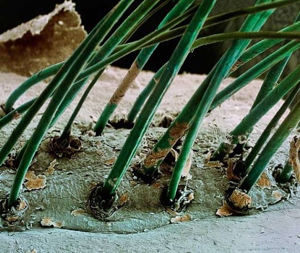 Muốn hay không thì bọ ký sinh Demodex vẫn đang hiển hiện trên lông mi của bạn như một phần cơ thể. Chúng tự nuôi bản thân bằng cách ăn những tế bào da chết và lượng dầu tiết ra từ các nang lông.