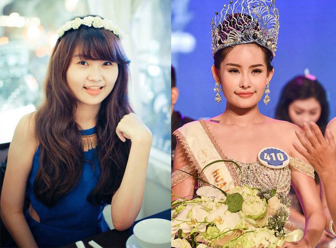 Điều đáng chú ý là hình ảnh Ngân Anh trước và sau cuộc thi quá khác biệt, nhất là cặp môi.