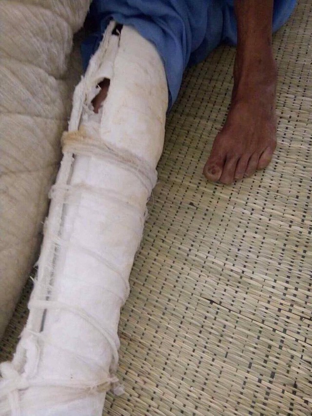 Ông N. bị con đánh mẻ bánh chè.