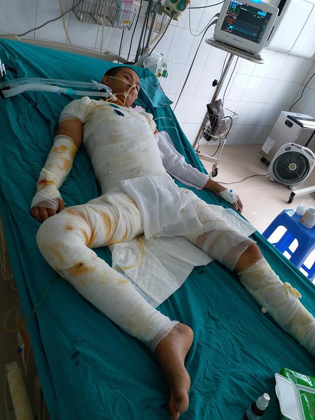 Hiện Tiến Anh vẫn đang được các bác sĩ tích cực theo dõi, điều trị.