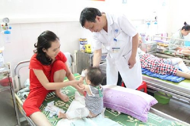 BS Thống cho biết, thời gian nghỉ h&egrave; số trẻ nhập viện do bỏng tăng l&ecirc;n.