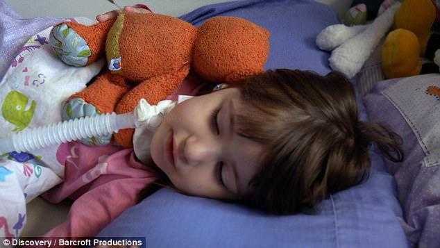 Khi ngủ, Paula cần m&aacute;y thở để cung cấp oxy th&ocirc;ng qua ống ở cổ của em. (Ảnh: dailymail)