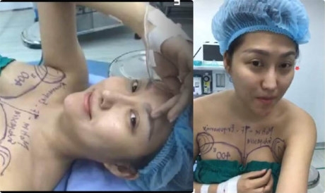Hình ảnh Phi Thanh Vân trước cuộc đại phẫu lần thứ 15 của mình