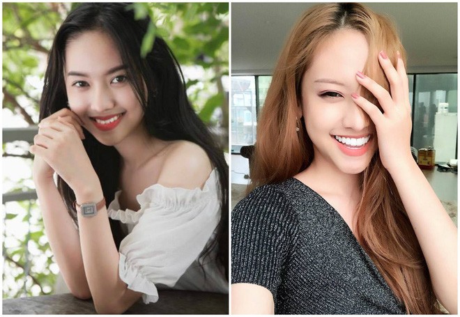 Thuý Vi bọc sứ 19 chiếc răng, chi phí thực hiện là xấp xỉ 250 triệu.