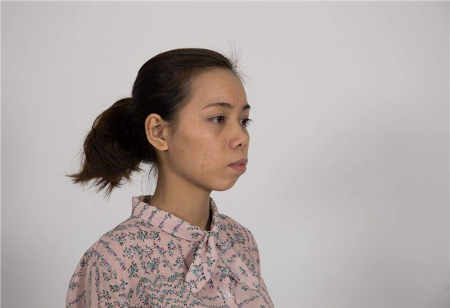 Đối với Kim Phượng cô nhân viên môi giới BĐS, quãng thời gian ngày trước thật sự rất đáng sợ. Thi thoảng bị đồng nghiệp dè bỉu, nói nhầm chỗ, cô lại bỏ ngoài tai. Dẫu biết ngoại hình xấu xúc phạm người nhìn khiến khách hàng không có mấy thiện cảm, nhưng vì đam mê mà cô vẫn cố gắng phấn đấu. Ở độ tuổi 24, Kim Phượng quyết định nhờ cậy đến phẫu thuật thẩm mỹ để dẹp bỏ đi mặc cảm vì ngoại hình kém ưa nhìn.