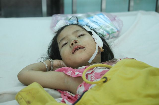 
B&eacute; g&aacute;i 5 tuổi l&agrave; nạn nh&acirc;n nhỏ tuổi nhất trong vụ tai nạn giao th&ocirc;ng nghi&ecirc;m trọng ở Chư S&ecirc;, Gia Lai.
