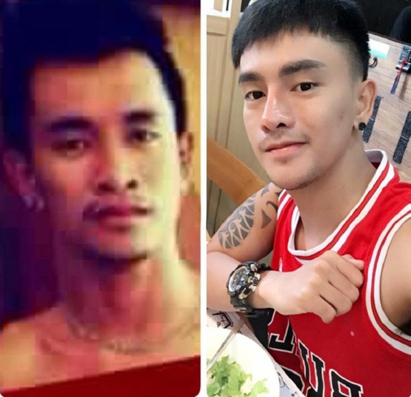 Ratchadapong trước và sau khi thẩm mỹ. Ảnh: dodenden