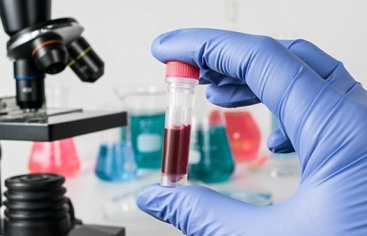 Xét nghiệm máu có thể phát hiện ra ung thư. Nguồn: Shutterstock.