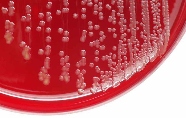 
Theo Mayo Clinic, nhiễm tụ cầu khuẩn là do vi khuẩn tụ cầu staphylococcus - thường được tìm thấy trên da hoặc ở mũi.
