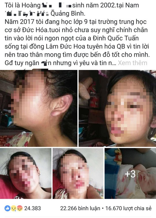 
Chị T. lên Facebook nói rằng mình bị chồng bạo hành
