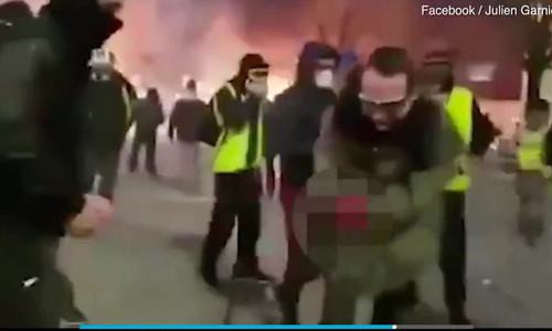 Người biểu tình áo vàng ở Pháp bị nổ nát bàn tay vì cầm lựu đạn cay. Ảnh cắt từ video