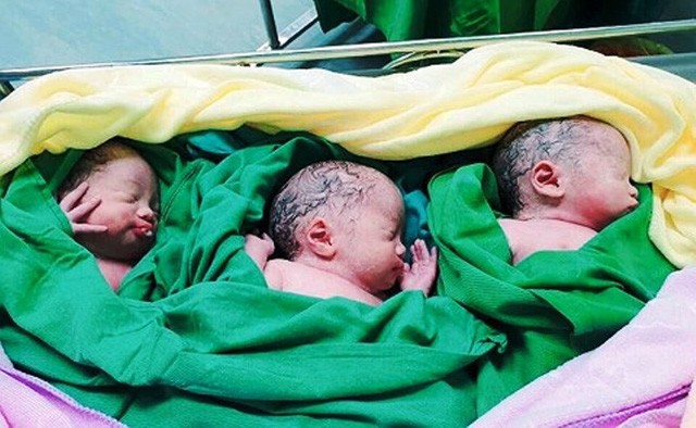 
3 bé gái chào đời khoẻ mạnh, hồng hào trong sự ngạc nhiên của cả bác sĩ và... mẹ đẻ
