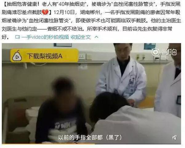 
Bệnh nhân ở Hồ Nam bị mắc bệnh viêm thuyên tắc mạch máu.
