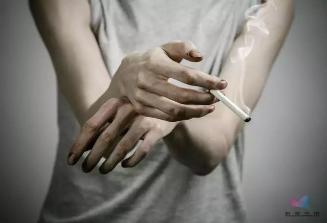 
Hầu hết các bệnh nhân bị viêm thuyên tắc mạch máu đều hút thuốc lá
