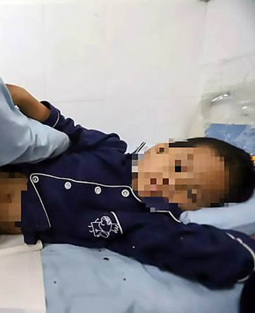 B&eacute; Hu hiện được c&aacute;c b&aacute;c sĩ bệnh viện huyện Haixing điều trị vết thương. Ảnh: AsiaWire.