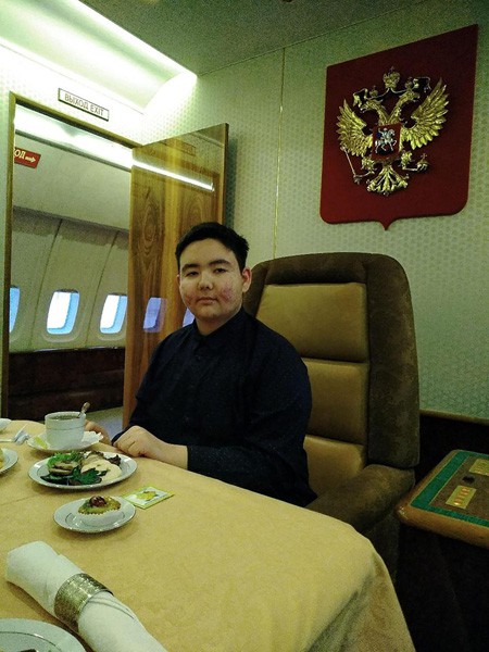 Arslan Kaipkulov, 15 tuổi, mắc một chứng rối loạn suy giảm miễn dịch hiếm gặp, khiến c&aacute;c khối u cứ thế ph&aacute;t triển b&ecirc;n trong cơ thể. Theo The Sun, Arslan l&agrave; người duy nhất ở Nga bị chẩn đo&aacute;n mắc t&igrave;nh trạng n&agrave;y.