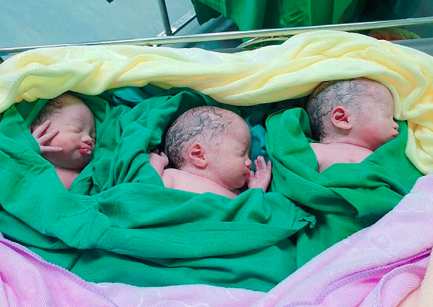 
Ba bé gái chào đời với cân nặng từ 2-2,2kg/bé.
