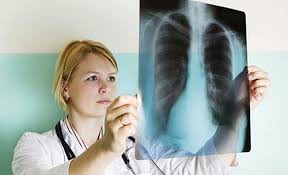 Chẩn đoán lao ở người già cũng gặp nhiều khó khăn; X-quang phổi thường không điển hình do chồng chéo cũng như dễ nhầm với nhiều bệnh phổi mãn tính khác ở người cao tuổi như viêm phế quản mạn tính, xơ phổi, giãn phế quản và đặc biệt là viêm phổi.