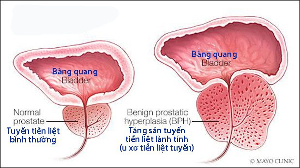 Ảnh minh họa. Nguồn: mayoclinic.org