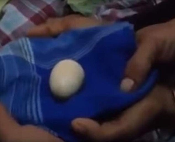 Quả trứng mà Akmal đẻ ra ở bệnh viện Syech Yusuf. Ảnh: Youtube