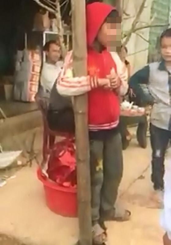 Cháu bé mặc áo khoác bên ngoài để che đi mớ dây xích trên cổ, tinh thần khá hoang mang sợ hãi.
