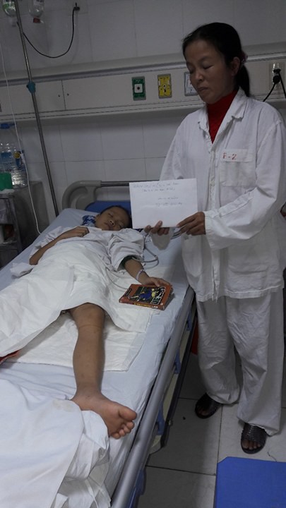 
Bé Lê Thị Quỳnh Như hiện đang được điều trị tại Bệnh viện Hữu nghị Việt Đức (ảnh gia đình cung cấp)
