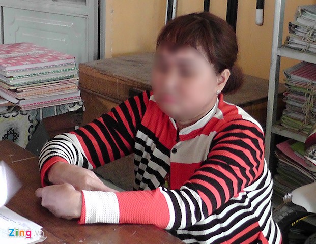 Bà Kim bị xử phạt hành chính vì hoang báo bị cướp tài sản. Ảnh: Minh Anh.