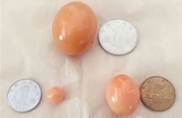 Hột v&agrave;ng to nhất ước t&iacute;nh bằng quả trứng g&agrave;.
