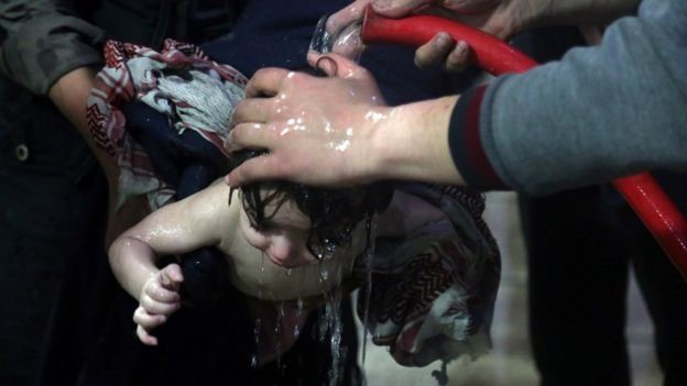 Một em bé được cấp cứu sau vụ việc được cho là tấn công hóa học tại Douma, Syria hôm 7/4. Ảnh: Reuters.