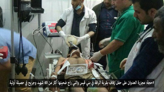 Nạn nhân được cấp cứu sau vụ không kích. Ảnh: Yemen Press