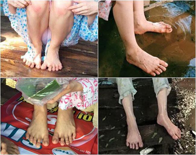Đôi chân xòe ít ai biết của Ngọc Trinh