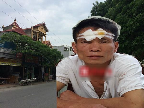 Đối tượng Bắc tại cơ quan công an.